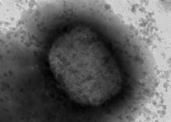 Imagen del Mokeypox tomada por un micriscopio electrónico | ISCIII